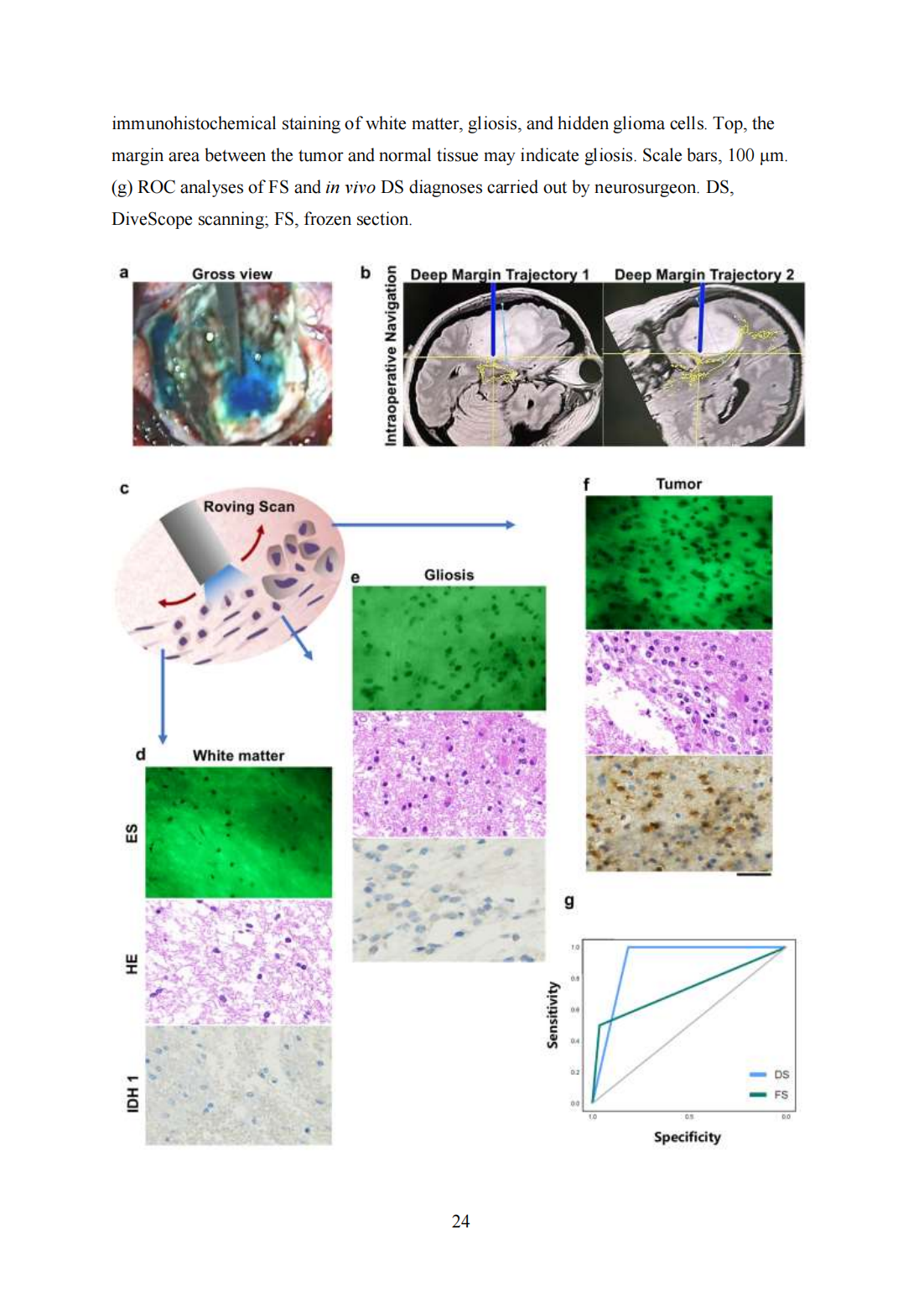 Roving histological imaging for navigation-confirmed glioma negative margin by handheld endomicroscopy: a parallel controlled study(图24)