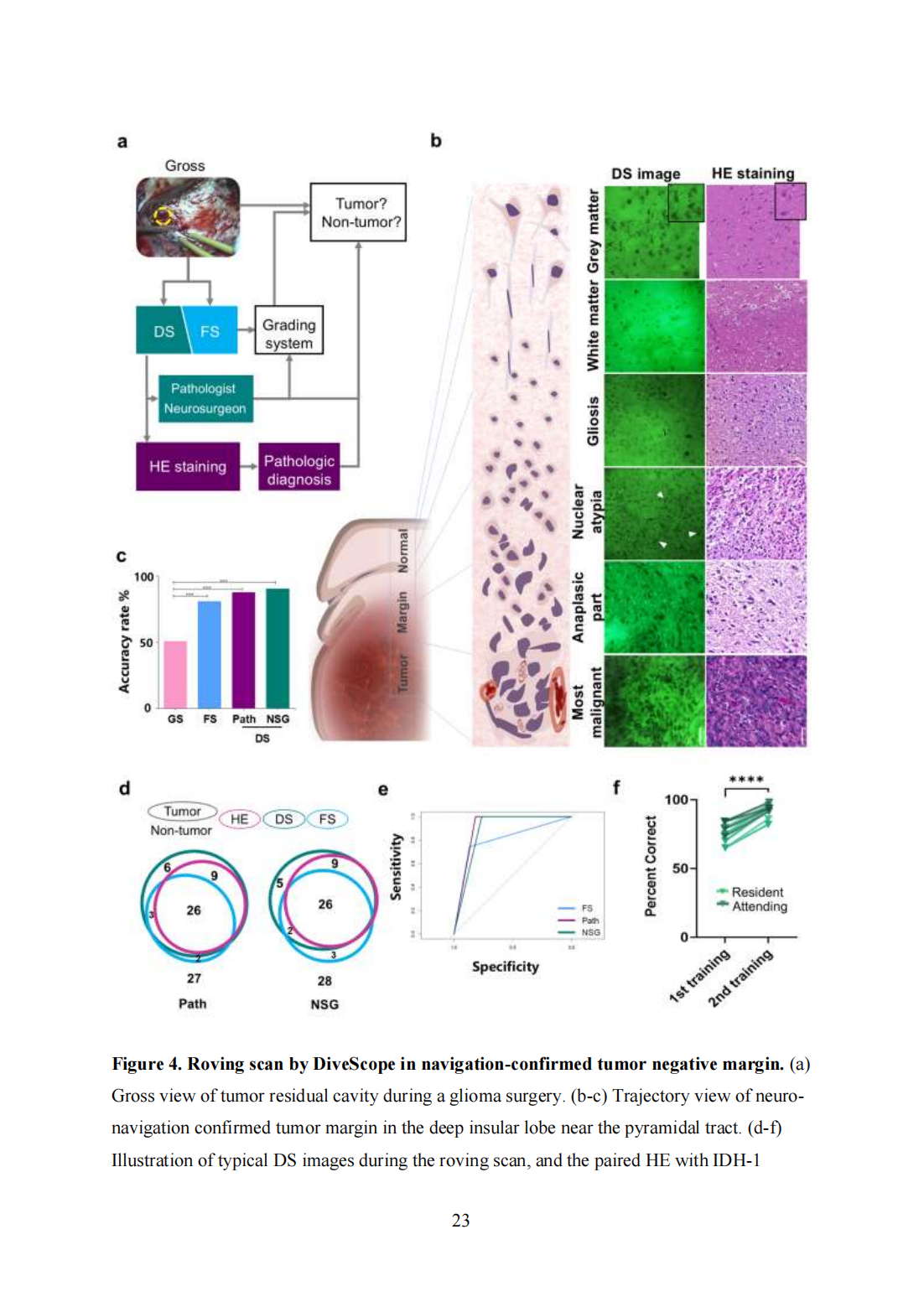 Roving histological imaging for navigation-confirmed glioma negative margin by handheld endomicroscopy: a parallel controlled study(图23)