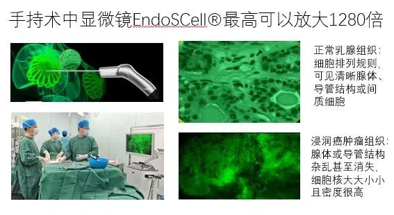 细胞级荧光导引技术亮相第二届赣南苏区乳腺肿瘤学术会议：EndoSCell®实现乳腺癌手术微米级精准切缘(图4)