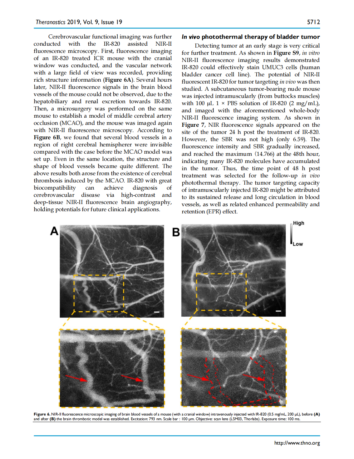 Excretable IR-820 for in vivo NIR-II fluorescence cerebrovascular imaging and photothermal therapy of subcutaneous tumor(图7)