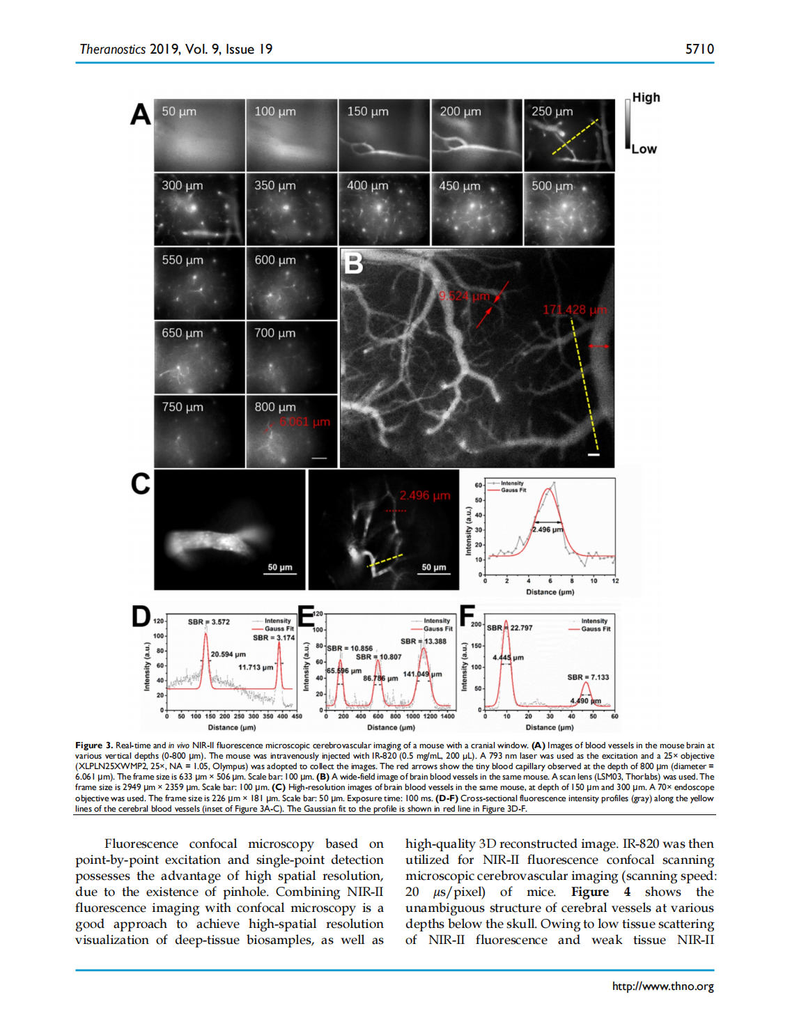 Excretable IR-820 for in vivo NIR-II fluorescence cerebrovascular imaging and photothermal therapy of subcutaneous tumor(图5)