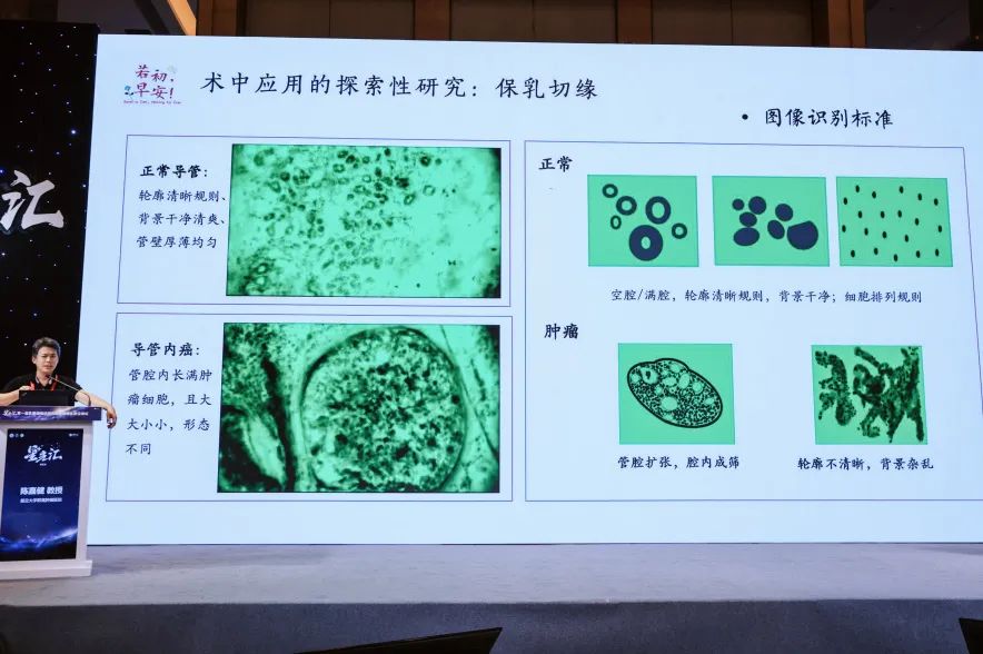 细胞级荧光导引技术亮相沈阳乳腺癌论坛，EndoSCell®破解术中切缘判读难题(图6)